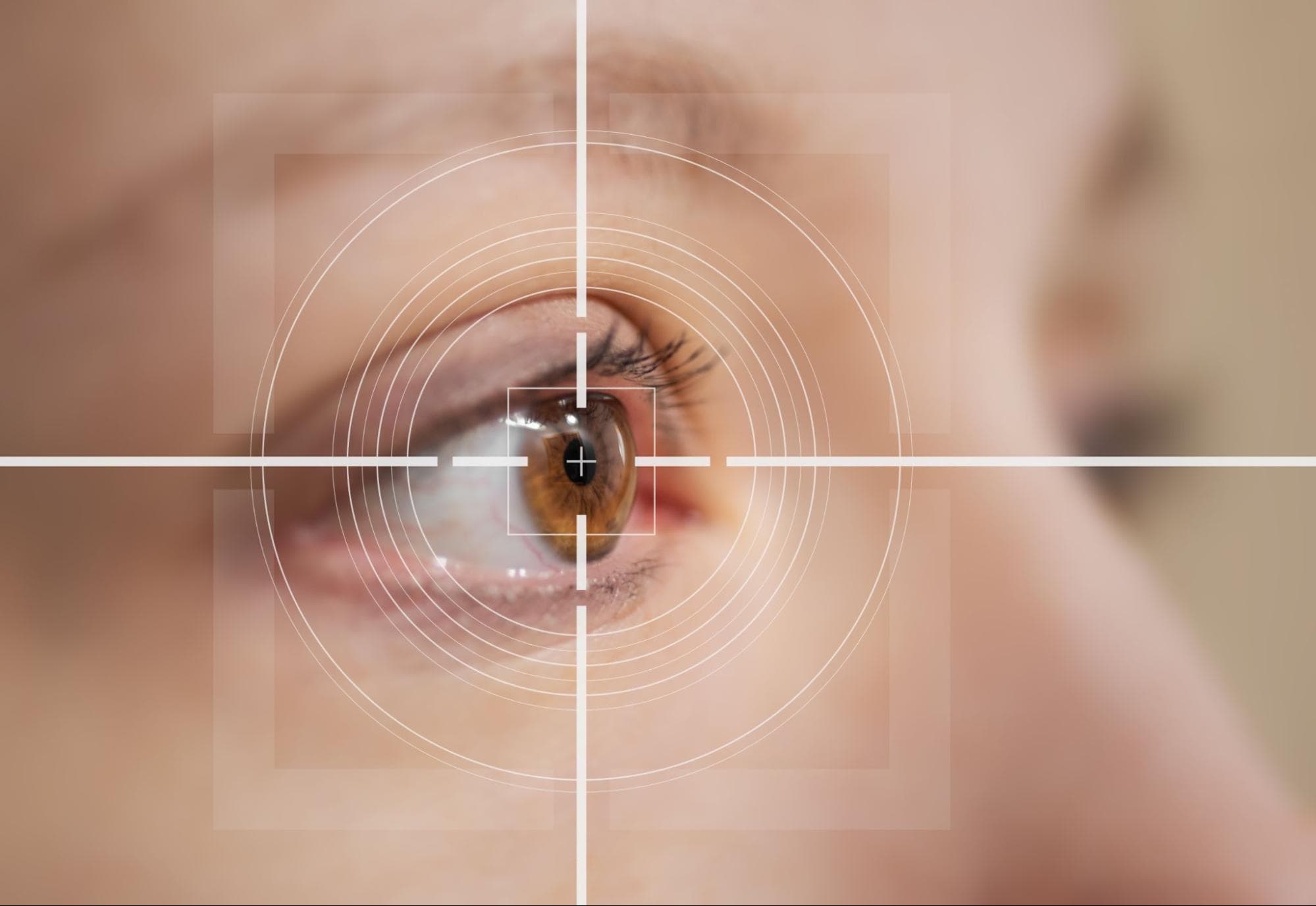 Enhancing Vision Further: Second LASIK Surgery – Is It Possible?
